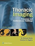 Thoracic Imaging Pulmonary And Cardiovascular Radiology English Edition