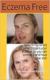 Eczema Free How To Figure Out What Triggers Your Eczema So You Can Control It And Have Clear Skin English Edition