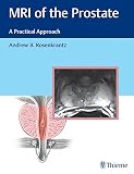 Mri Of The Prostate A Practical Approach English Edition