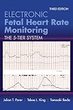 Electronic Fetal Heart Rate Monitoring English Edition