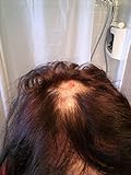 A Hairstylists Approach To Winning The Head Lice War What Really Works