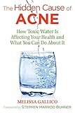 The Hidden Cause Of Acne How Toxic Water Is Affecting Your Health And What You Can Do About It