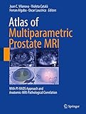Atlas Of Multiparametric Prostate Mri With Pirads Approach And Anatomicmripathological Correlation English Edition