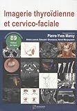 Imagerie Thyroidienne Et Cervicofaciale