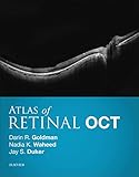 Atlas Of Retinal Oct Ebook Optical Coherence Tomography English Edition