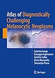 Atlas Of Diagnostically Challenging Melanocytic Neoplasms English Edition