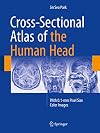 Cross-Sectional Atlas of the Human Head With 0.1-mm pixel size color images