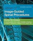 Atlas Of Imageguided Spinal Procedures Ebook English Edition