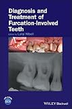 Diagnosis And Treatment Of Furcationinvolved Teeth English Edition