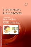 Understanding Gallstones