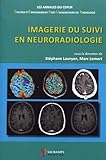 Imagerie Du Suivi En Neuroradiologie
