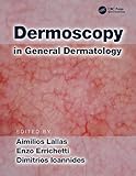Dermoscopy In General Dermatology English Edition
