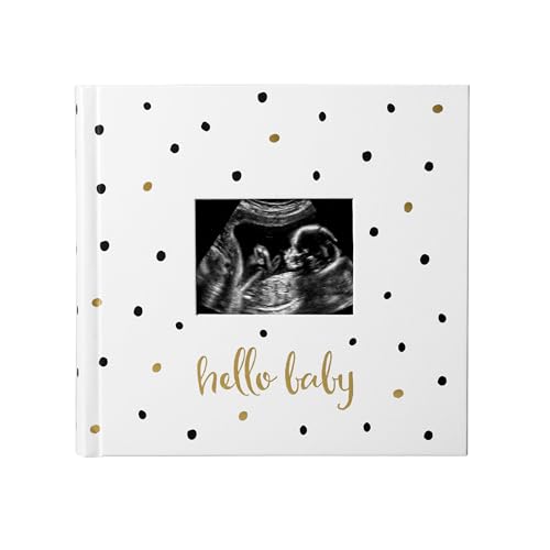 Pearhead Hello Baby Photo Album, Keepsake Book for New and Expecting Parents, Gender-Neutral Baby Accessory, Ideal Gift for Baby Shower, Holds 200 Pictures, Black and Gold Polka Dot