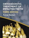 Orthodontic Treatment Of Impacted Teeth English Edition