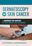 Dermatoscopy And Skin Cancer A Handbook For Hunters Of Skin Cancer And Melanoma English Edition