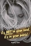 Endometriosis Its Not In Your Head Its In Your Pelvis