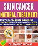 Skin Cancer Natural Treatment Everything You Need To Know About Skin Cancers Causes Signs Symptoms The Best Natural Treatments For Good And Prevention