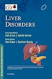 SGRH Health Series: Liver Disorders