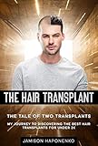 The Hair Transplant The Tail Of Two Transplants My Journey To Discovering The Best Hair Transplants For Under 2k