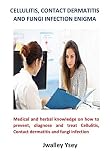Cellulitis Contact Dermatitis And Fungi Infection Enigma Medical And Herbal Knowledge On How To Prevent Diagnose And Treat Cellulitis Contact Dermatitis And Fungi Infection