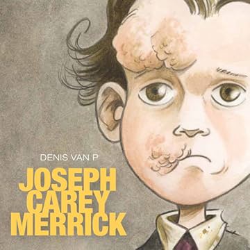 Joseph Carey Merrick