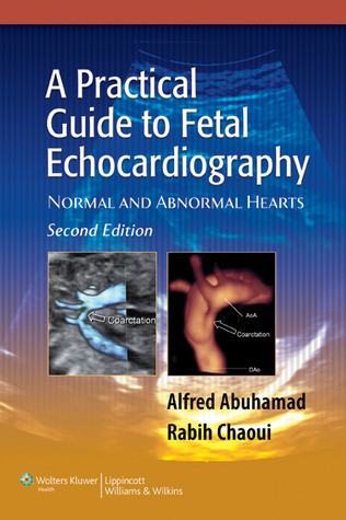 健康・医学 A Practical Guide to Fetal A Practical Guide to Fetal Echocardiography: Normal and