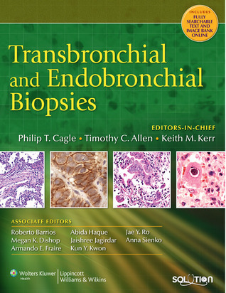 Transbronchial and Endobronchial Biopsies