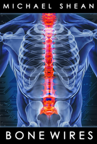 Bone Wires