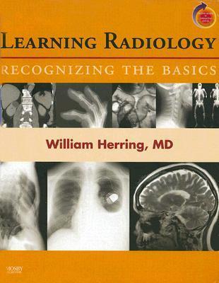 Learning Radillogy Learning Radiology: Recognizing the Basics [with Student Consult Online ...