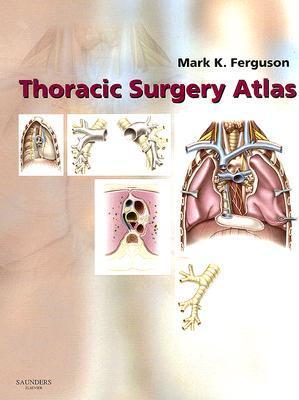 Thoracic Surgery Atlas By Mark K Ferguson Md Goodreads