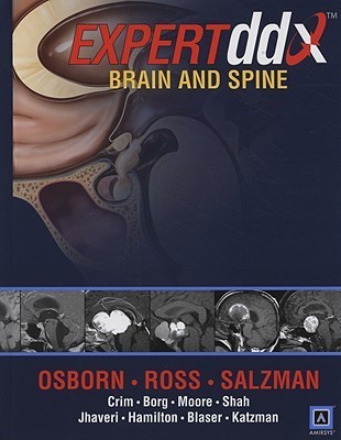 洋書 Expert ddx brain and spine ExpertDDx: Brain and Spine: 9780443106941: Medicine & Health