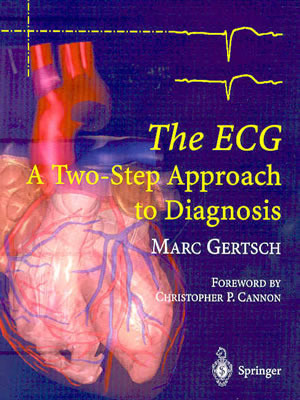 Marc Ries Ecg The ECG: A Two-Step Approach to Diagnosis by Marc Gertsch | Goodreads