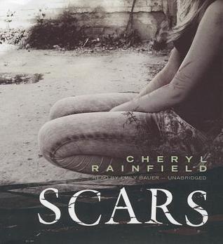 Scars