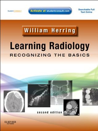 Learning Radillogy Learning Radiology: Recognizing the Basics E-Book by William Herring ...
