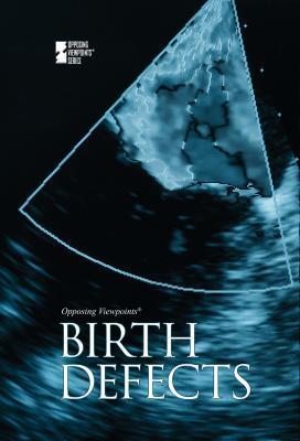 Birth Defects (Opposing Viewpoints) by Gale Cengage Learning | Goodreads