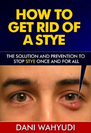 How to Get Rid of a Stye: The Solution and Prevention to Stop Stye Once ...