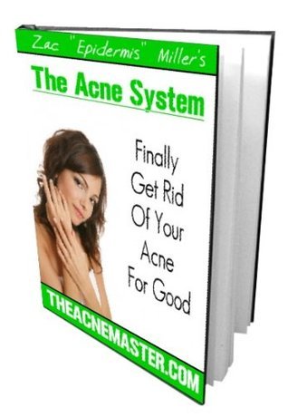 The Acne System: How to Get Rid of Even The Most Severe Acne Fast and ...