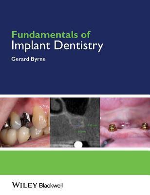Fundamentals of Implant Dentistry by Gerard Byrne | Goodreads