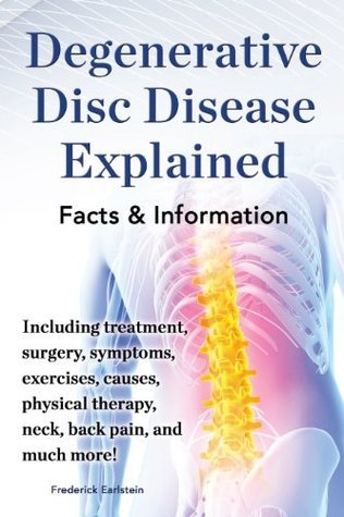 Degenerative Disc Disease Explained: Including treatment, surgery ...