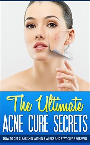 The Ultimate Acne Cure Secrets: How To Get Clear Skin Within 3 Weeks