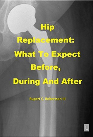 Hip Replacement: What To Expect Before, During and After by Rupert ...