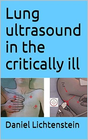 Lung ultrasound in the critically ill by Daniel Lichtenstein | Goodreads