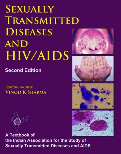 Sexually Transmitted Diseases and HIV/AIDS by Vinod K. Sharma | Goodreads