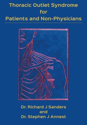 Thoracic Outlet Syndrome for Patients and Non-Physicians: Explained in ...