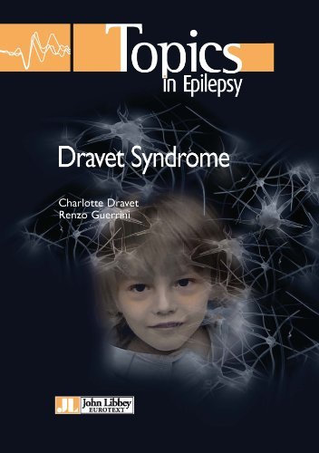 Dravet Syndrome (Topics in Epilepsy Book 3) by Charlotte Dravet | Goodreads