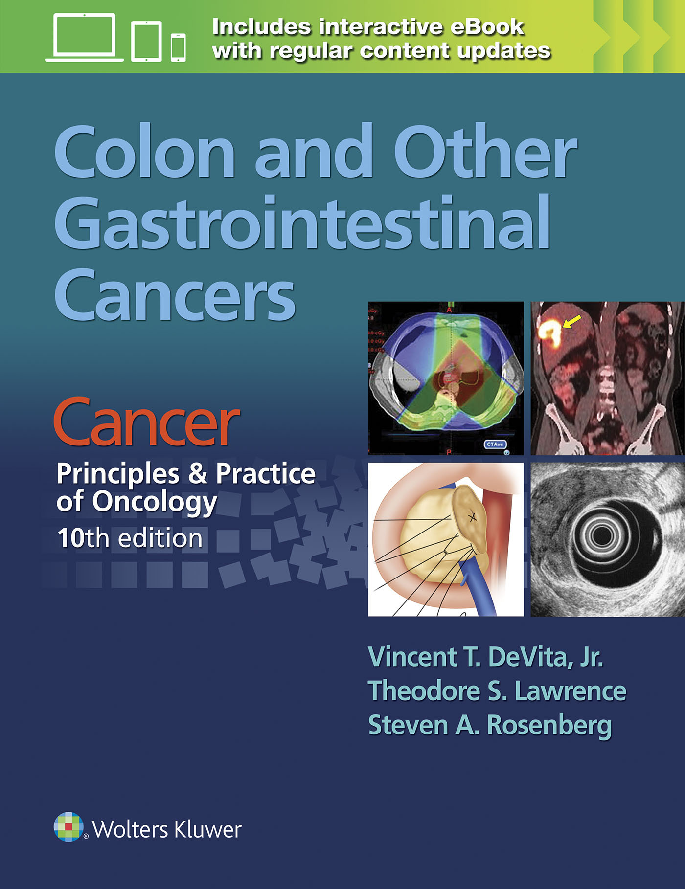 Colon and Other Gastrointestinal Cancers Cancer Principles & Practice