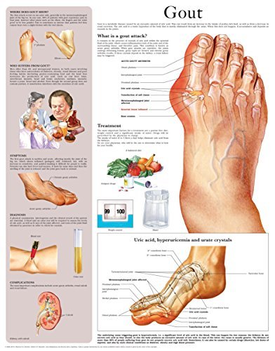 Gout Chart.pdf Gout e-chart: Full illustrated by HC-HealthComm | Goodreads