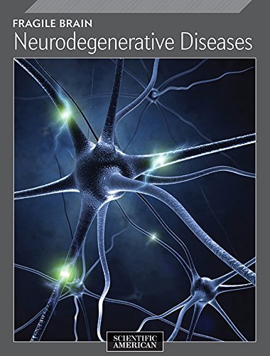 Fragile Brain book cover