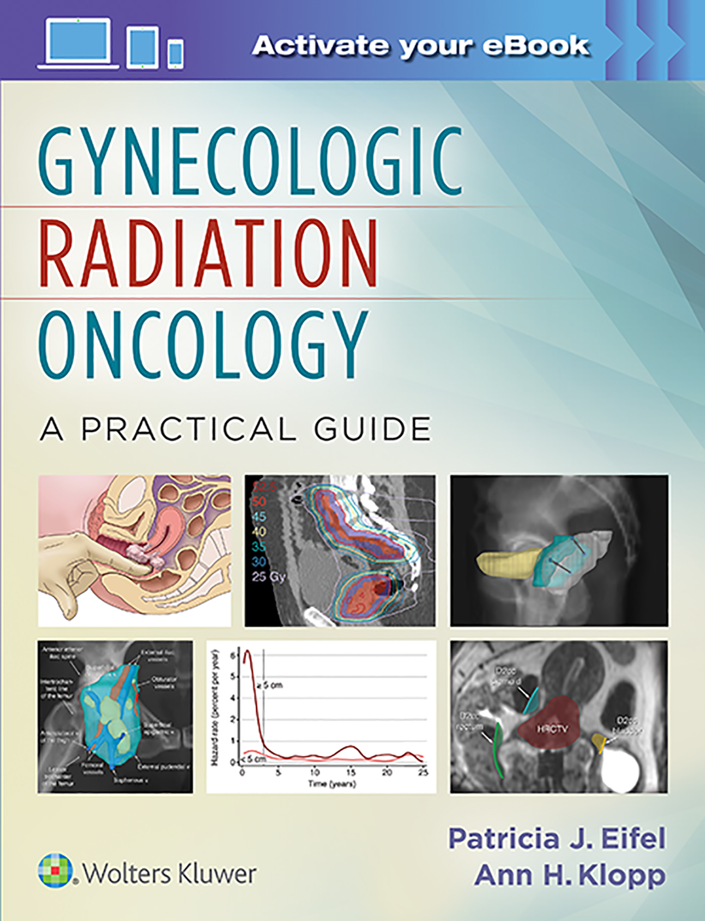 Gynecologic Radiation Oncology: A Practical Guide by Patricia Eifel ...