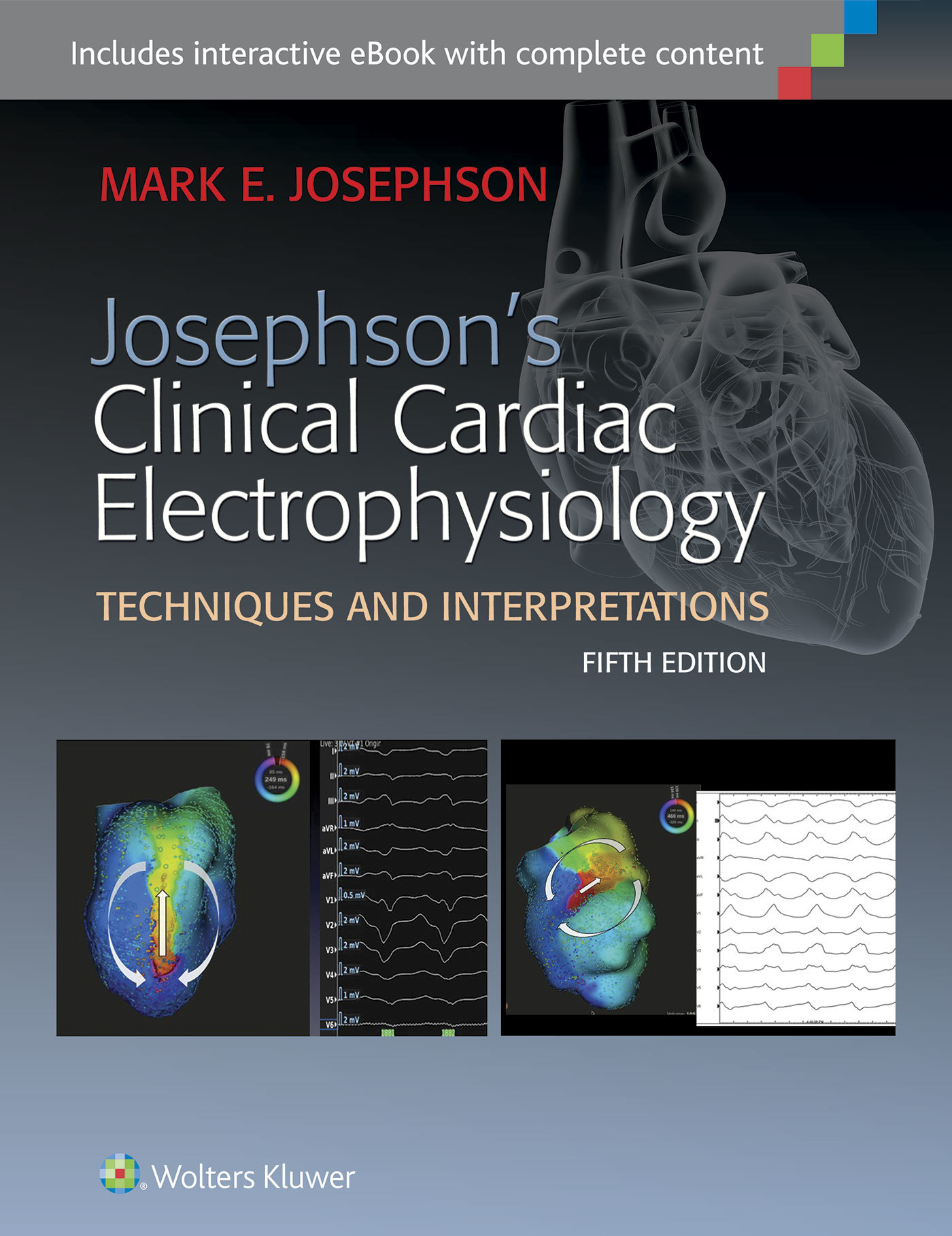 Josephson's Clinical Cardiac Electrophysiology by Mark E. Josephson MD